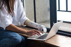 Picture of a woman typing on a laptop next to a window.  She is typing with a prosthetic on her left hand.